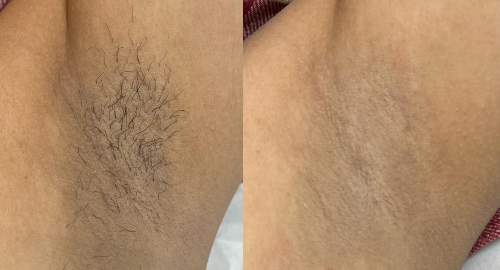 Waxing